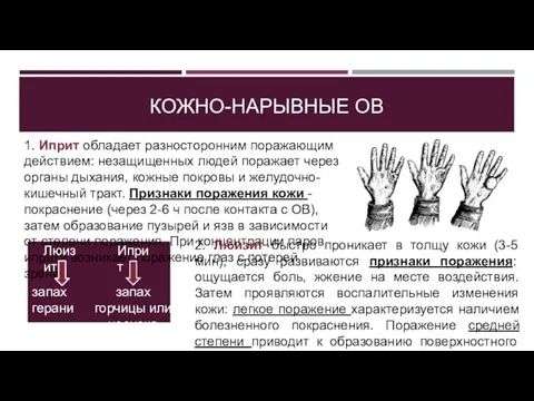 КОЖНО-НАРЫВНЫЕ ОВ 1. Иприт обладает разносторонним поражающим действием: незащищенных людей поражает через