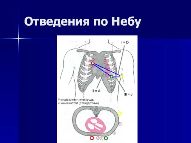 Отведения по Небу