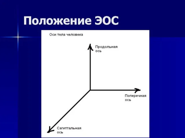 Положение ЭОС