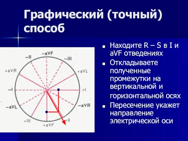 Графический (точный) способ Находите R – S в I и aVF отведениях