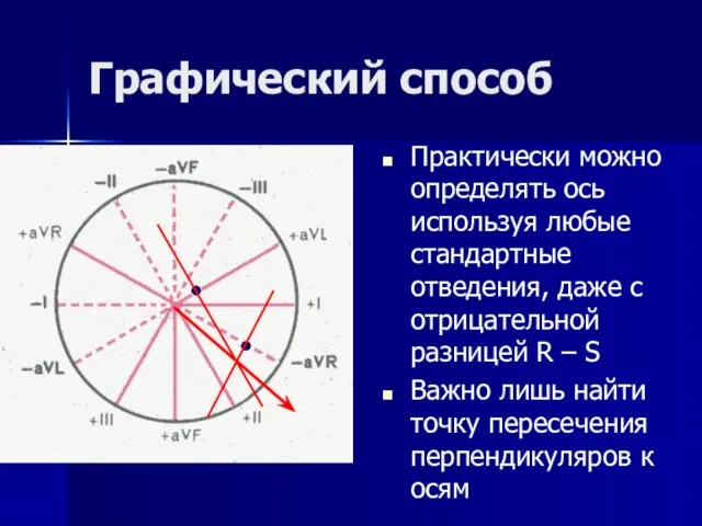 Графический способ Практически можно определять ось используя любые стандартные отведения, даже с