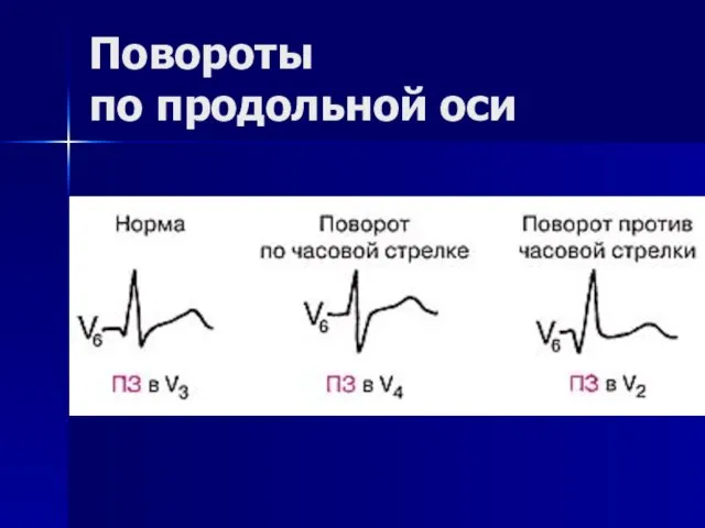 Повороты по продольной оси