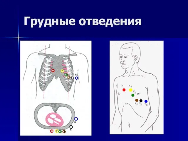 Грудные отведения