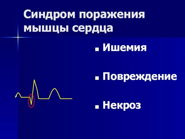 Ишемия Повреждение Некроз Синдром поражения мышцы сердца