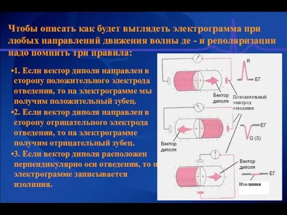 Чтобы описать как будет выглядеть электрограмма при любых направлений движения волны де