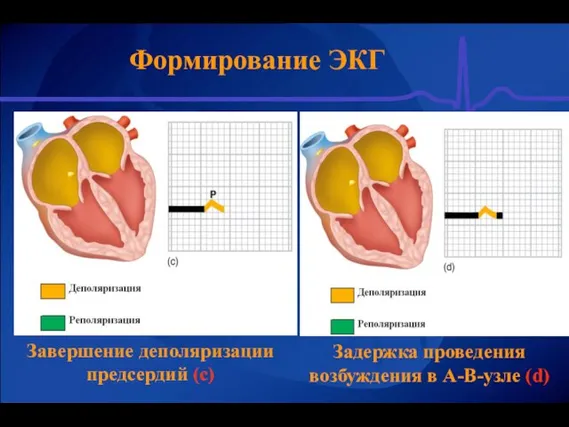 Формирование ЭКГ Завершение деполяризации предсердий (с) Задержка проведения возбуждения в А-В-узле (d)