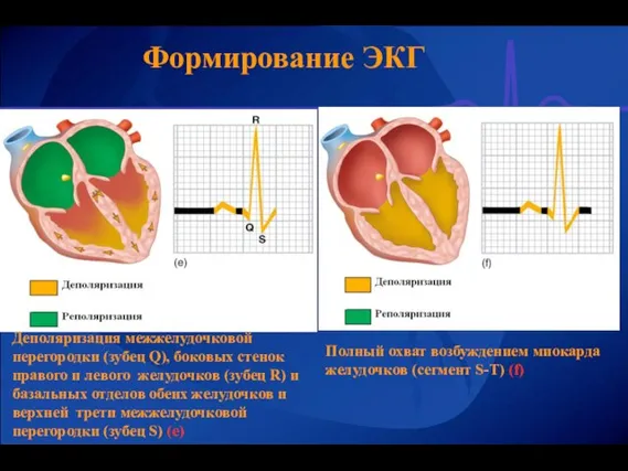 Формирование ЭКГ Деполяризация межжелудочковой перегородки (зубец Q), боковых стенок правого и левого