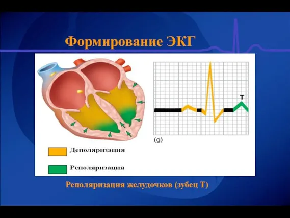 Формирование ЭКГ Реполяризация желудочков (зубец Т)