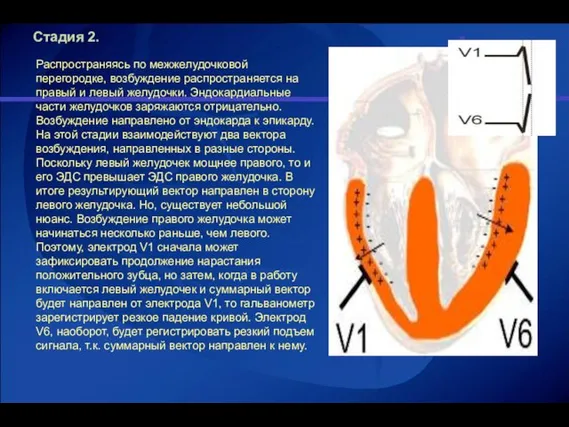 Стадия 2. Распространяясь по межжелудочковой перегородке, возбуждение распространяется на правый и левый