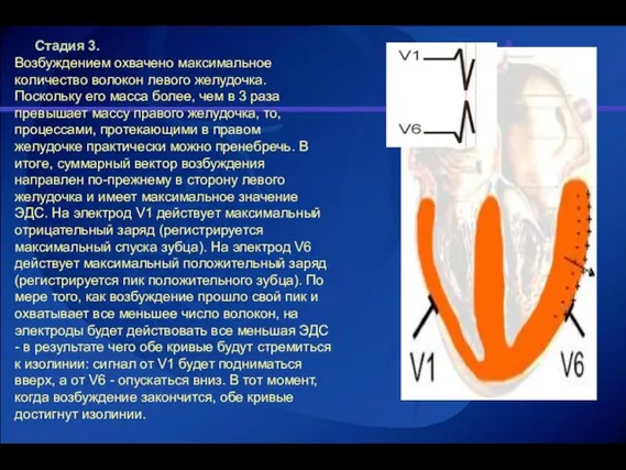 Стадия 3. Возбуждением охвачено максимальное количество волокон левого желудочка. Поскольку его масса