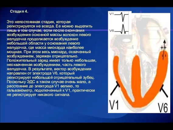 Стадия 4. Это непостоянная стадия, которая регистрируется не всегда. Ее можно выделить