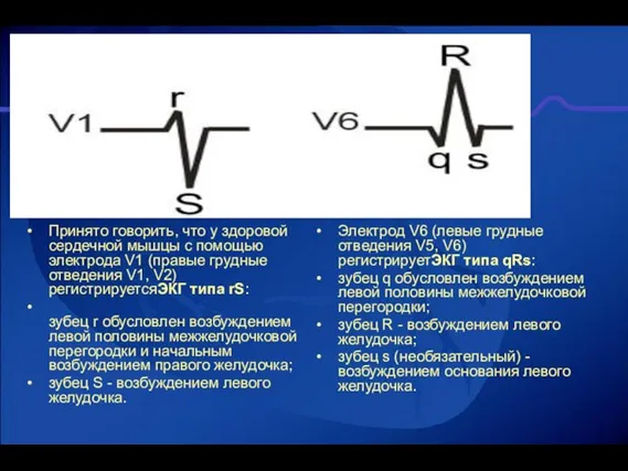 Принято говорить, что у здоровой сердечной мышцы с помощью электрода V1 (правые