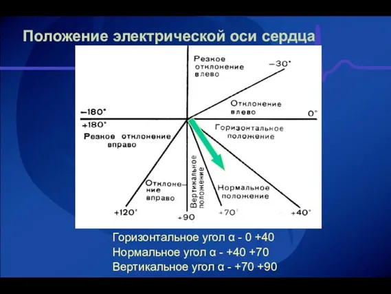 Положение электрической оси сердца Горизонтальное угол α - 0 +40 Нормальное угол