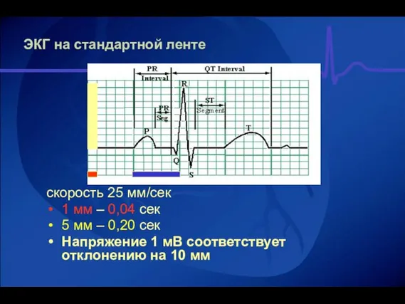 ЭКГ на стандартной ленте скорость 25 мм/сек 1 мм – 0,04 сек