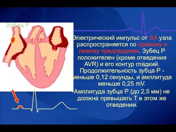 Зубец P Электрический импульс от SA узла распространяется по правому и левому