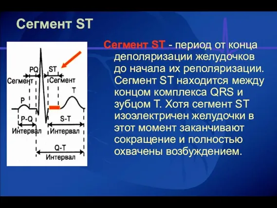 Сегмент ST Сегмент ST - период от конца деполяризации желудочков до начала