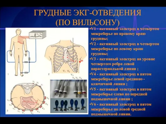 ГРУДНЫЕ ЭКГ-ОТВЕДЕНИЯ (ПО ВИЛЬСОНУ) V1 - активный электрод в четвертом межреберье по