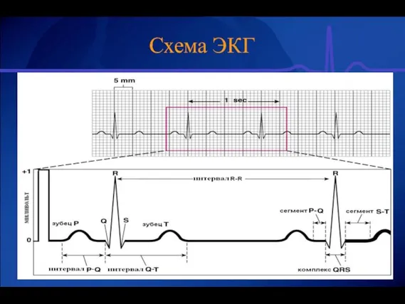 Схема ЭКГ
