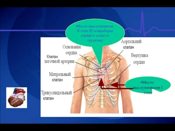 Место выслушивания ІІ тона (ІІ межреберье справа и слева от грудины) Место выслушивания І тона