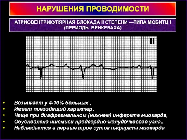 НАРУШЕНИЯ ПРОВОДИМОСТИ АТРИОВЕНТРИКУЛЯРНАЯ БЛОКАДА II СТЕПЕНИ —ТИПА МОБИТЦ I (ПЕРИОДЫ ВЕНКЕБАХА) Возникает