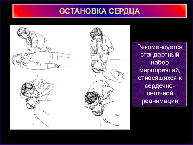 ОСТАНОВКА СЕРДЦА Рекомендуется стандартный набор мероприятий, относящихся к сердечно-легочной реанимации