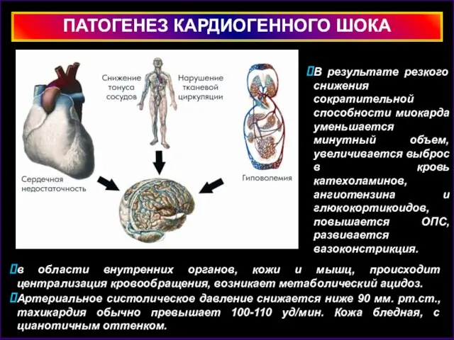 ПАТОГЕНЕЗ КАРДИОГЕННОГО ШОКА в области внутренних органов, кожи и мышц, происходит централизация