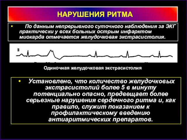 НАРУШЕНИЯ РИТМА По данным непрерывного суточного наблюдения за ЭКГ практически у всех