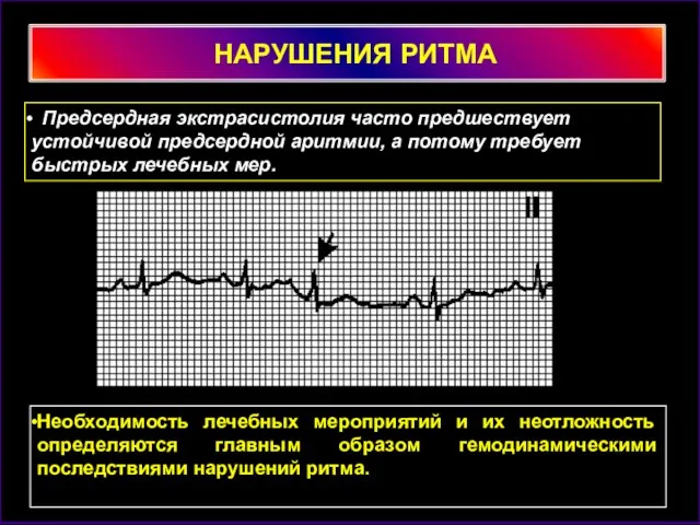 НАРУШЕНИЯ РИТМА Предсердная экстрасистолия часто предшествует устойчивой предсердной аритмии, а потому требует