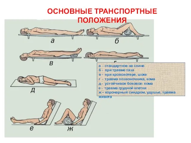 ОСНОВНЫЕ ТРАНСПОРТНЫЕ ПОЛОЖЕНИЯ а - стандартное на спине б - при травме