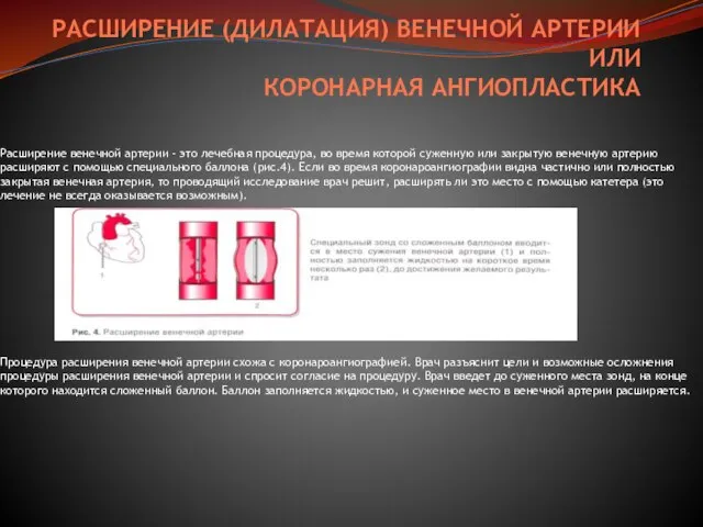 РАСШИРЕНИЕ (ДИЛАТАЦИЯ) ВЕНЕЧНОЙ АРТЕРИИ ИЛИ КОРОНАРНАЯ АНГИОПЛАСТИКА Расширение венечной артерии - это