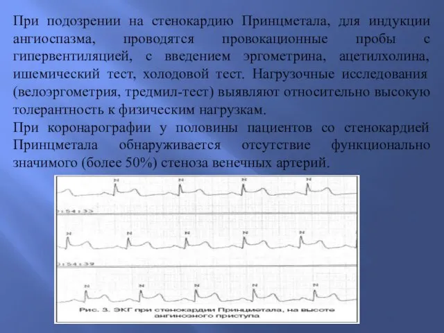 При подозрении на стенокардию Принцметала, для индукции ангиоспазма, проводятся провокационные пробы с