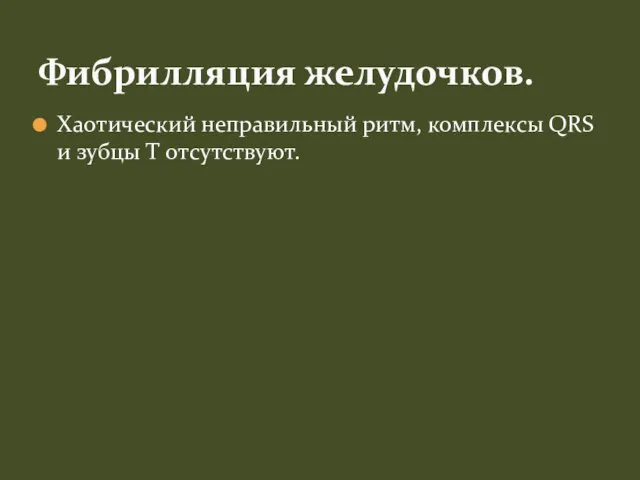 Хаотический неправильный ритм, комплексы QRS и зубцы T отсутствуют. Фибрилляция желудочков.