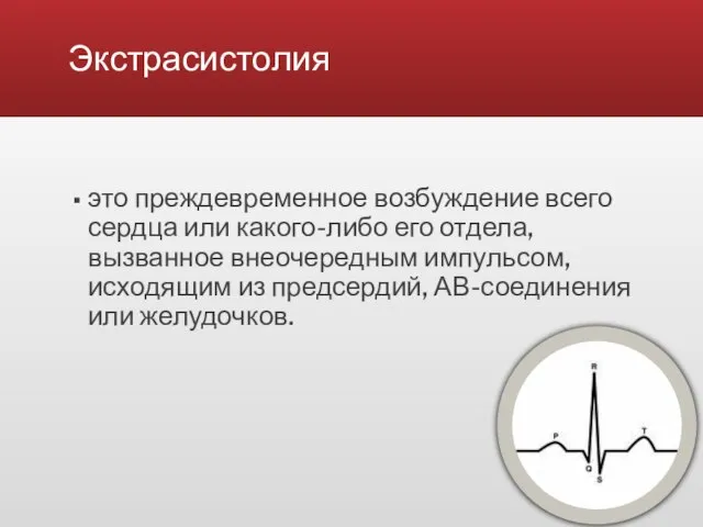 Экстрасистолия это преждевременное возбуждение всего сердца или какого-либо его отдела, вызванное внеочередным