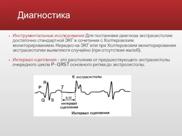 Диагностика Инструментальные исследования Для постановки диагноза экстрасистолии достаточно стандартной ЭКГ в сочетании