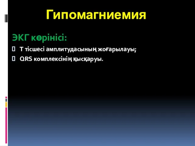 Гипомагниемия ЭКГ көрінісі: Т тісшесі амплитудасының жоғарылауы; QRS комплексінің қысқаруы.