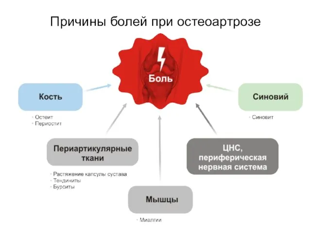 Причины болей при остеоартрозе