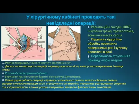 У хірургічному кабінеті проводять такі невідкладні операції: 1. Реанімаційні заходи: ШВЛ, інкубація