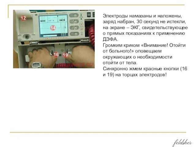 Электроды намазаны и наложены, заряд набран, 30 секунд не истекли, на экране