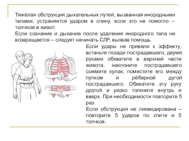 Тяжёлая обструкция дыхательных путей, вызванная инородными телами, устраняется ударом в спину, если