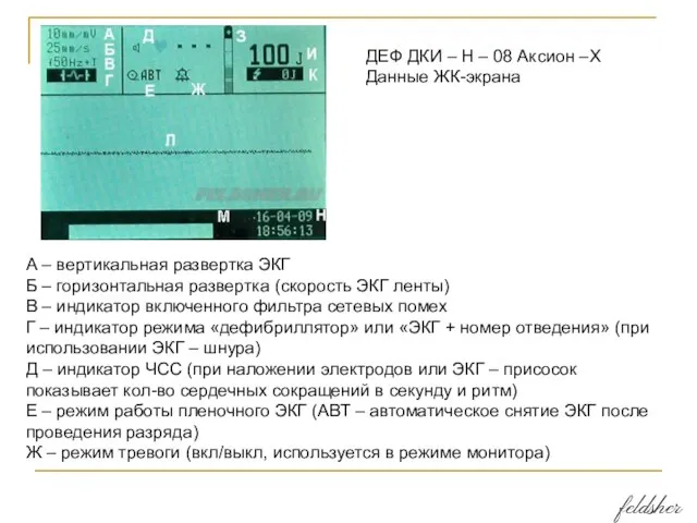 ДЕФ ДКИ – Н – 08 Аксион –Х Данные ЖК-экрана А –