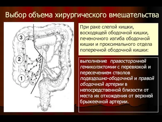 Выбор объема хирургического вмешательства