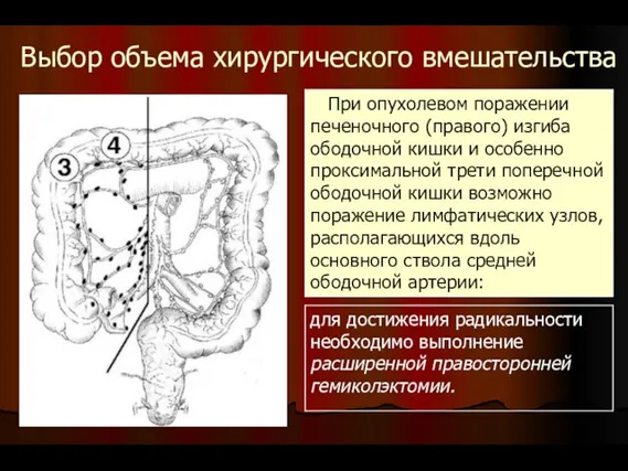 Выбор объема хирургического вмешательства