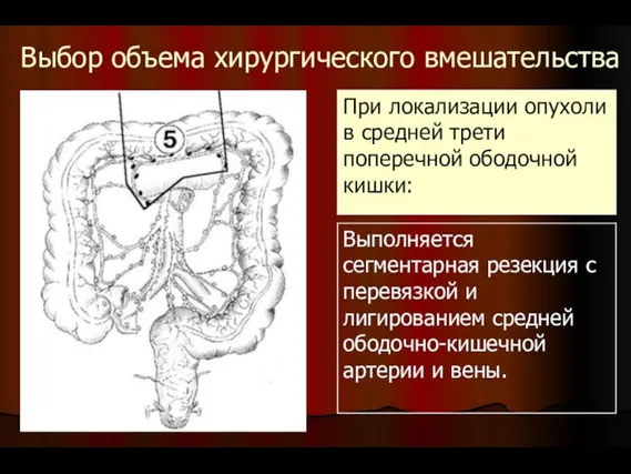 Выбор объема хирургического вмешательства