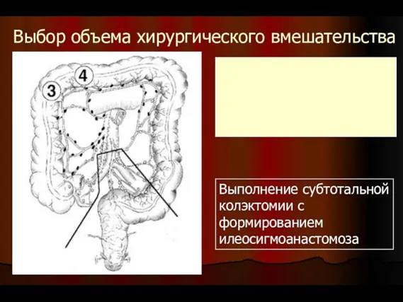 Выбор объема хирургического вмешательства