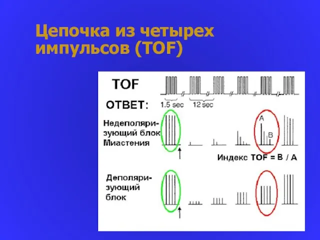 Цепочка из четырех импульсов (TOF)