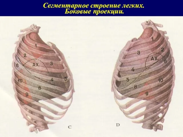 Сегментарное строение легких. Боковые проекции.