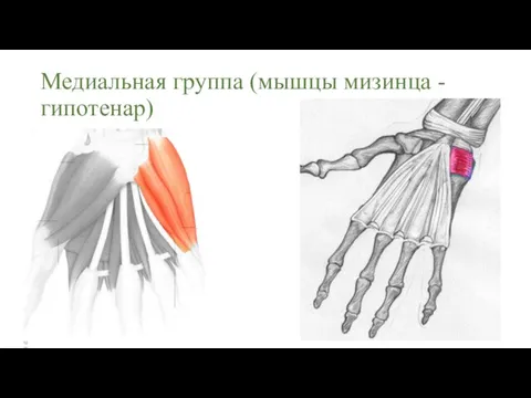 Медиальная группа (мышцы мизинца - гипотенар)