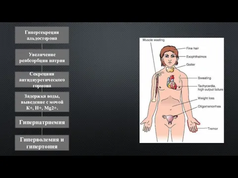 Гиперсекреция альдостерона Увеличение реабсорбции натрия Секрециия антидиуретического гормона Задержка воды, выведение с