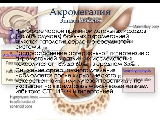 Акромегалия Эпидемиология Наиболее частой причиной летальных исходов (до 60% случаев) больных акромегалией