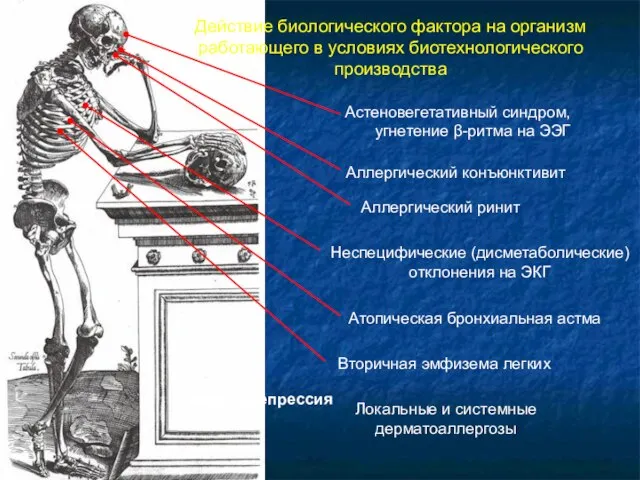 Действие биологического фактора на организм работающего в условиях биотехнологического производства Астеновегетативный синдром,